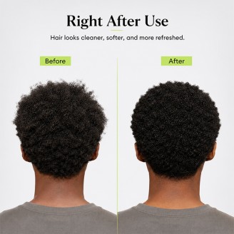 Natural Anti-Dandruff Nourishing and Repairing Shampoo